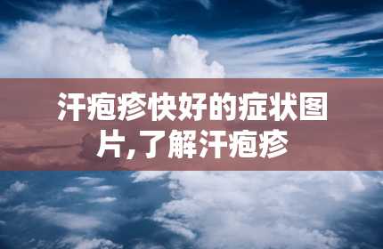 汗疱疹快好的症状图片,了解汗疱疹